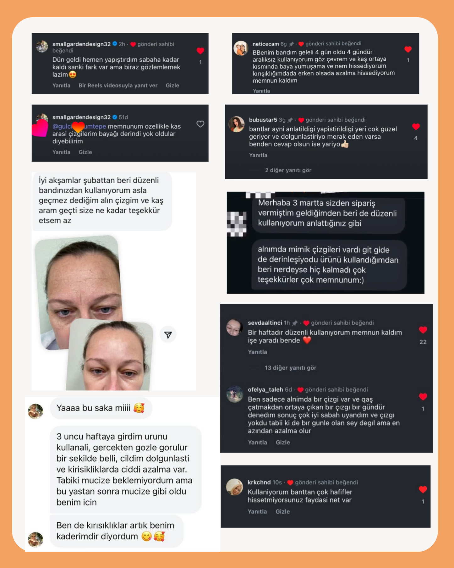 Sakira Beauty Kolajen Bandı