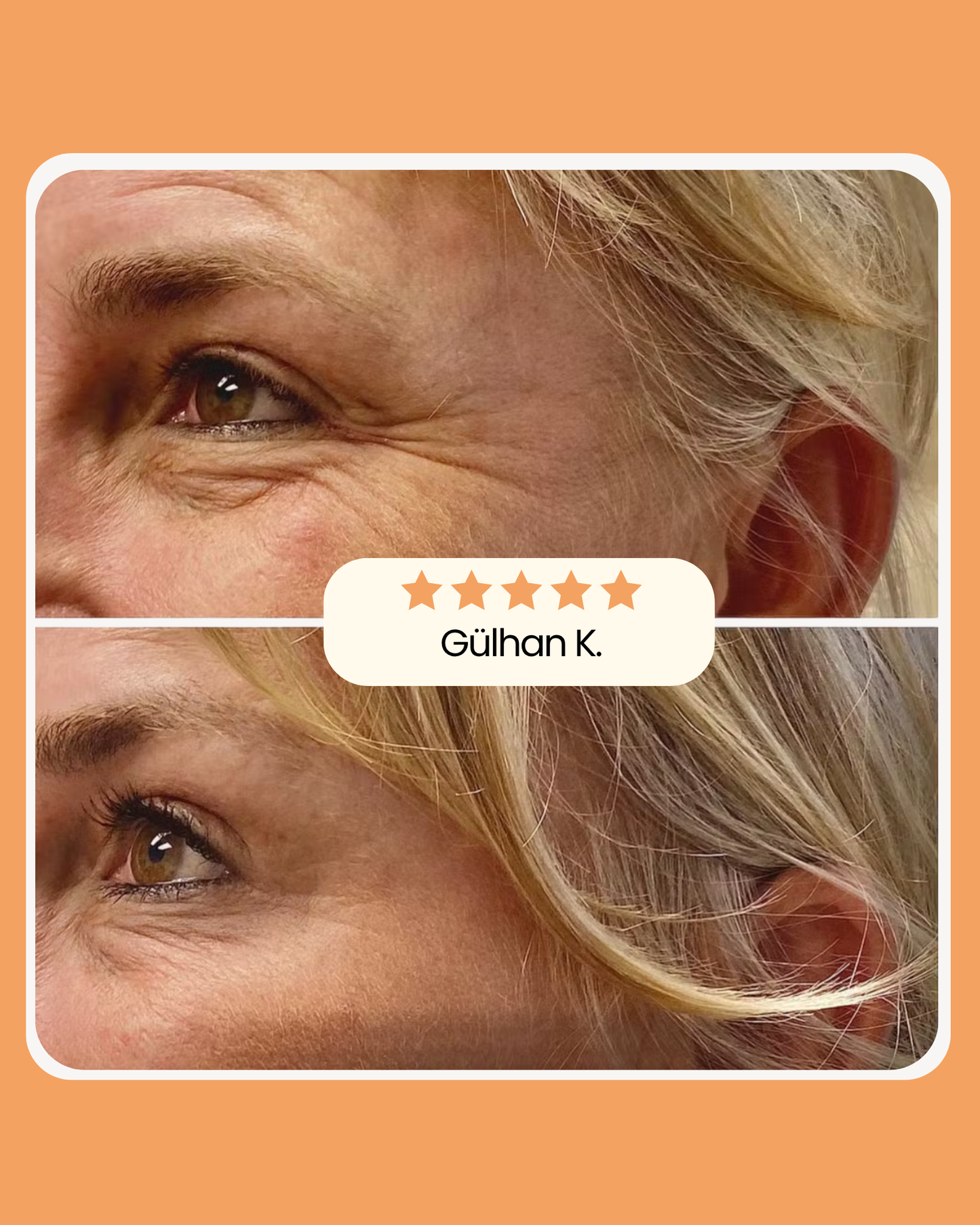 Sakira Beauty Kolajen Bandı
