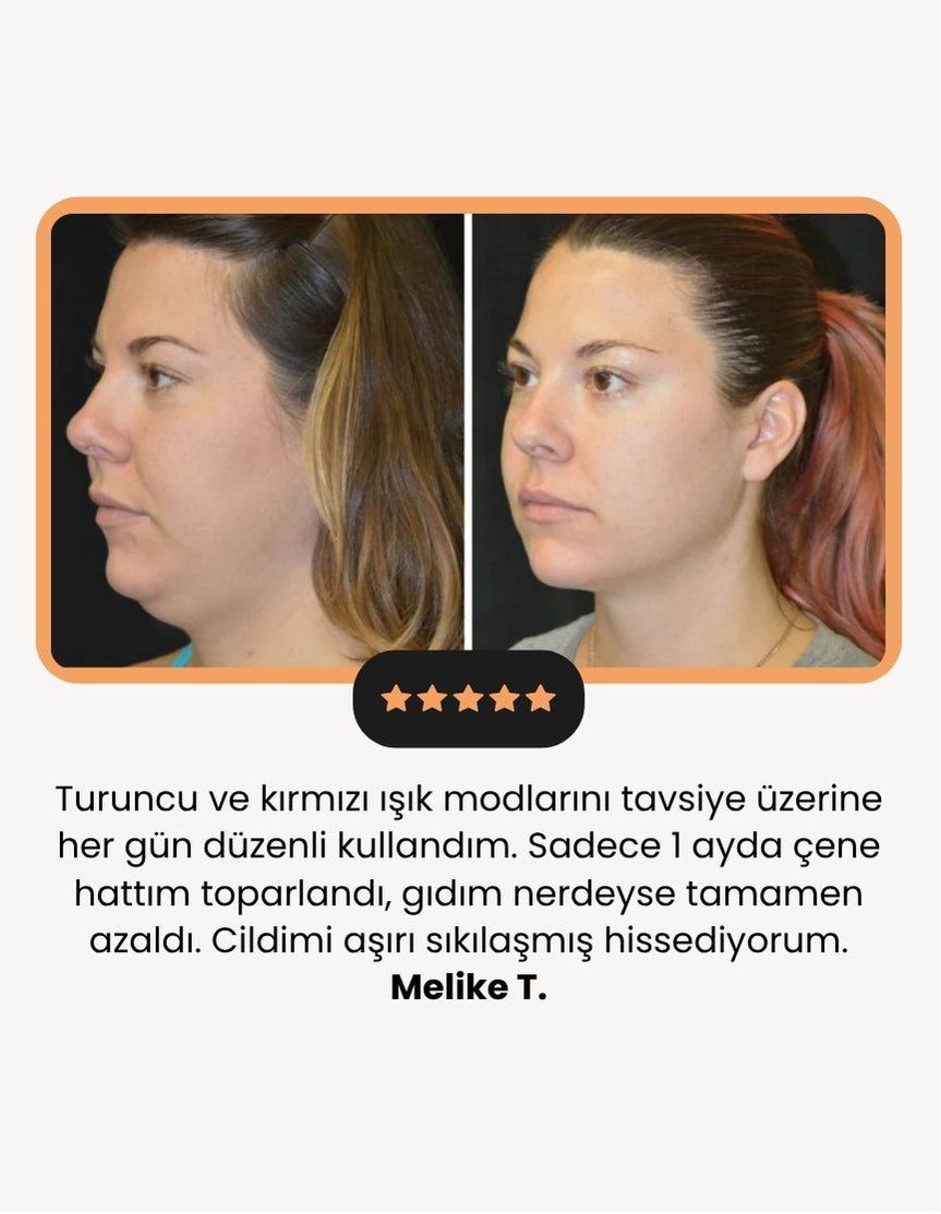 Sakira Beauty 7 Işık Cilt Terapisi