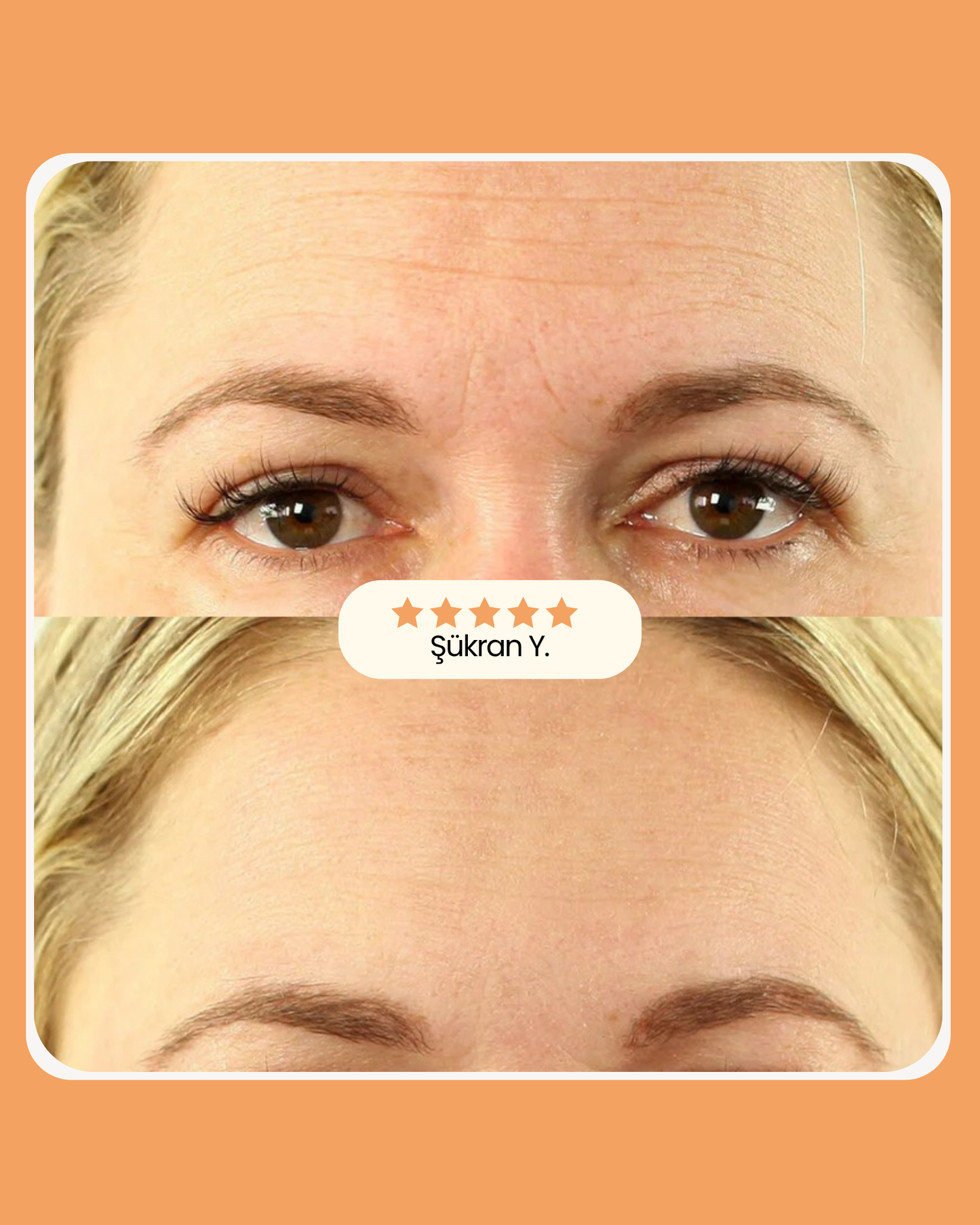 Sakira Beauty Kolajen Bandı