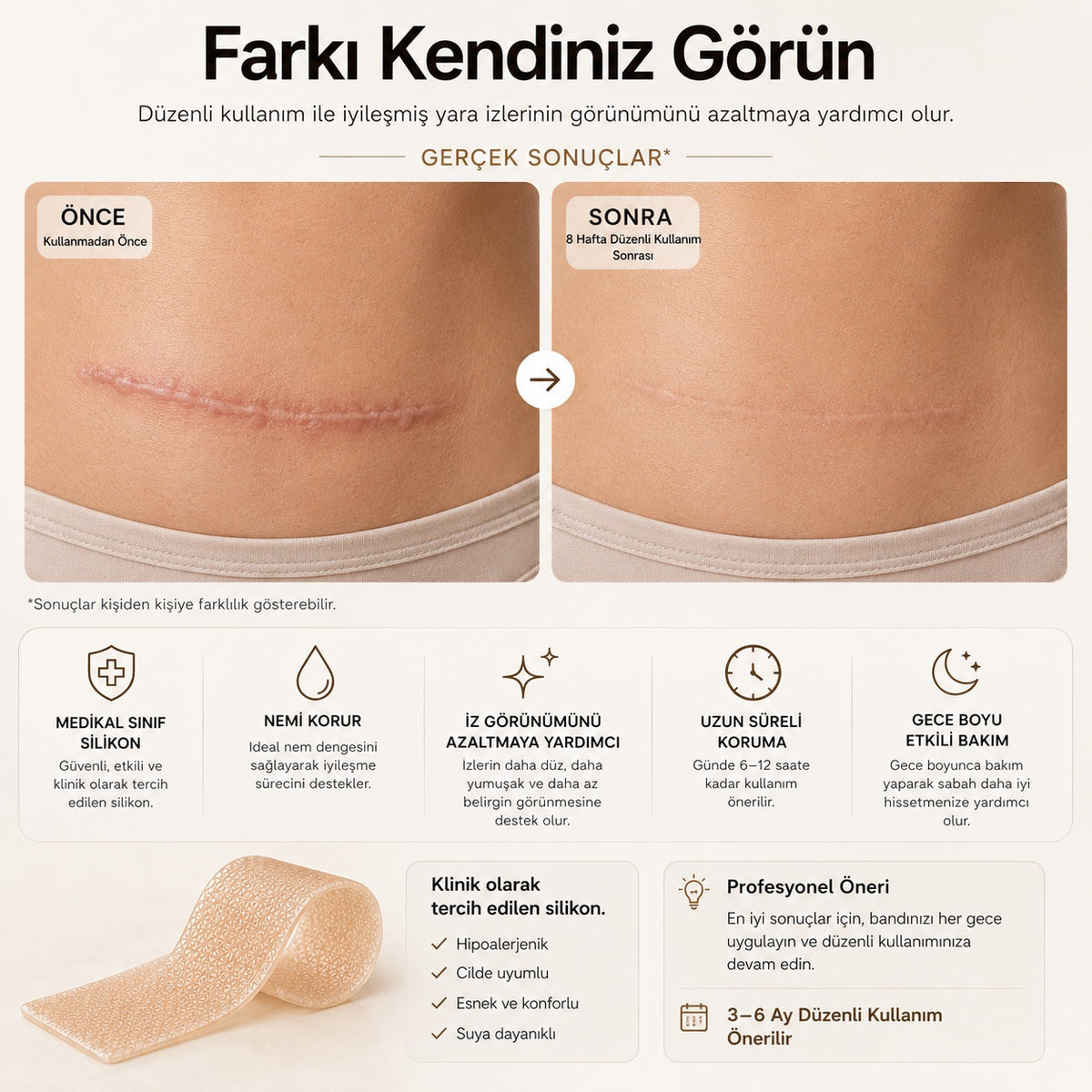 Sakira | Medikal Silikon İz Bakım Bandı